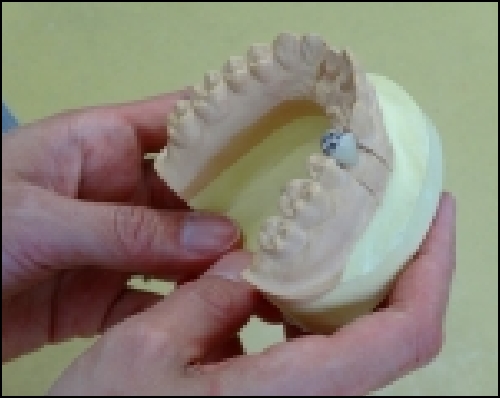 歯科技工装置の展示