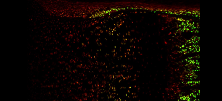 Shinsuke Ohba IHC-1 
                     Immunofluorescence for Runx2 (red) and Sp7 (green) in the growth plate and primary spongiosa of a P1 mouse tibia