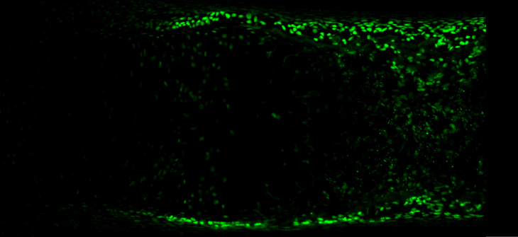 Shinsuke Ohba IHC-2 
                     Immunofluorescence for Sp7 (green) in an E15.5 mouse femur