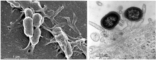 P. gingivalisの細胞侵入とエンドサイトーシス