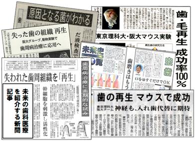 大阪大学の未来歯科医療を紹介する新聞記事 