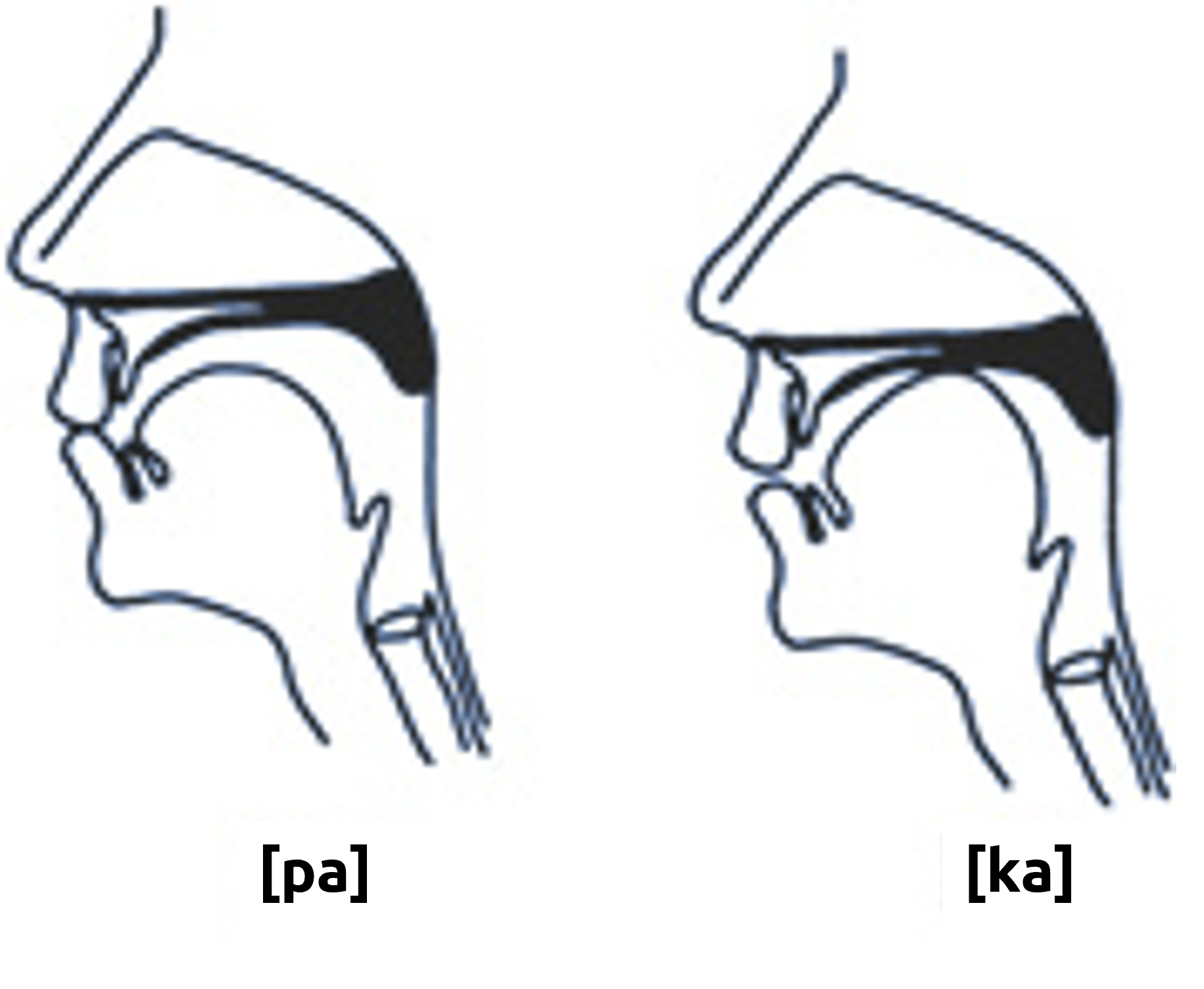 Example of pronunciation that requires velopharyngeal closure